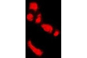 Immunofluorescence (IF) image for anti-Peptidyl Arginine Deiminase, Type IV (PADI4) antibody (ABIN7306048)