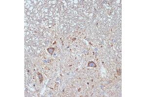Immunohistochemistry of paraffin-embedded mouse spinal cord using CBR1 Rabbit mAb (ABIN7266076) at dilution of 1:100 (40x lens). (CBR1 抗体)