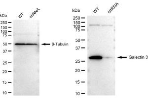 Western blotting analysis using Galectin 3 antibody (ABIN7798687).