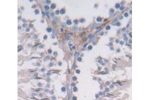 Used in DAB staining on fromalin fixed paraffin- embedded lung tissue (BCAR1 抗体  (AA 1-240))