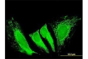 Immunofluorescence of purified MaxPab antibody to RTKN2 on HeLa cell. (RTKN2 抗体  (AA 1-163))
