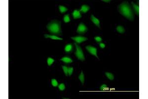 Immunofluorescence of purified MaxPab antibody to ETHE1 on HeLa cell. (ETHE1 抗体  (AA 1-254))