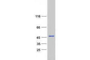 Western Blotting (WB) image for Calponin 3, Acidic (CNN3) protein (Myc-DYKDDDDK Tag) (ABIN2713071)