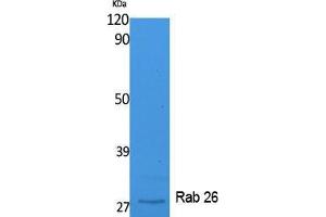Western Blotting (WB) image for anti-RAB26, Member RAS Oncogene Family (RAB26) (C-Term) antibody (ABIN3178106) (RAB26 抗体  (C-Term))