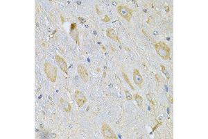 Immunohistochemistry of paraffin-embedded mouse brain using TXNDC5 Antibody. (TXNDC5 抗体  (AA 1-324))