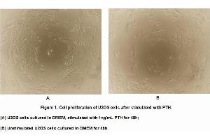 Image no. 2 for Parathyroid Hormone (PTH) (AA 32-115) (Active) protein (MBP tag,His tag) (ABIN5665891) (PTH Protein (AA 32-115) (MBP tag,His tag))