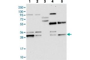 Western blot analysis of Lane 1: RT-4, Lane 2: U-251 MG, Lane 3: Human Plasma, Lane 4: Liver, Lane 5: Tonsil with PPTC7 polyclonal antibody  at 1:250-1:500 dilution. (PPTC7 抗体)