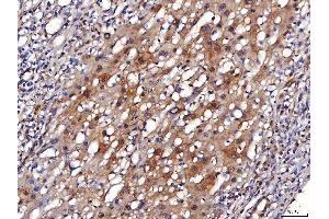 IHC analysis of ENO1 using anti-ENO1 antibody (ABIN7601902).