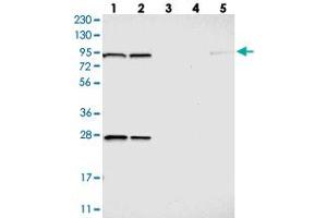 Western blot analysis of Lane 1: RT-4, Lane 2: U-251 MG, Lane 3: Human Plasma, Lane 4: Liver, Lane 5: Tonsil with GCS1 polyclonal antibody .