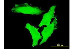 Immunofluorescence of monoclonal antibody to CHUK on HeLa cell. (IKK alpha 抗体  (AA 646-745))