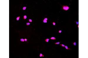 anti-Collagen Triple Helix Repeat Containing 1 (CTHRC1) (AA 31-243) antibody