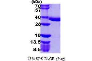 SDS-PAGE (SDS) image for Phosphopantothenoylcysteine Synthetase (PPCS) (AA 1-331) protein (His tag) (ABIN667454) (PPCS Protein (AA 1-331) (His tag))