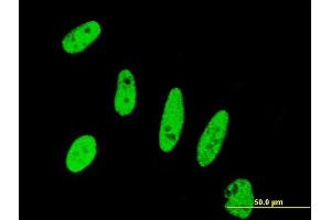 Immunofluorescence of monoclonal antibody to BIRC5 on HeLa cell. (Survivin 抗体  (AA 1-100))
