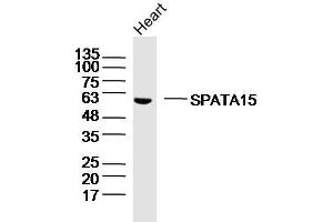 Mouse heart lysates probed with SPATA15/SPATC1 Polyclonal Antibody, Unconjugated  at 1:300 dilution and 4˚C overnight incubation. (SPATC1 抗体  (AA 1-100))