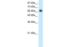 WB Suggested Anti-FOXG1B Antibody Titration:  1. (FOXG1 抗体  (C-Term))
