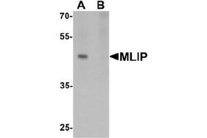 Western blot analysis of MLIP in 293 cell lysate with MLIP antibody at 1 ug/mL in (A) the absence and (B) the presence of blocking peptide. (MLIP 抗体  (C-Term))