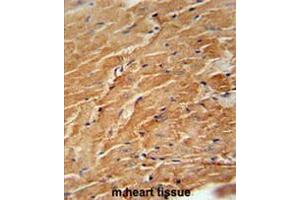 CCL21 Antibody (Center) immunohistochemistry analysis in formalin fixed and paraffin embedded mouse heart tissue followed by peroxidase conjugation of the secondary antibody and DAB staining. (CCL21 抗体  (Middle Region))