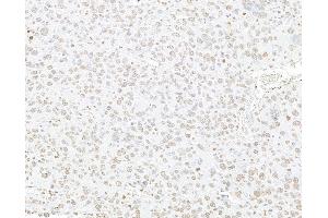 Immunohistochemistry (IHC) image for anti-Histone H3 (H3) (C-Term) antibody (ABIN7455227) (Histone 3 抗体  (C-Term))
