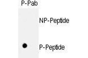 Image no. 1 for anti-Retinoblastoma 1 (RB1) (pSer811) antibody (ABIN358217)