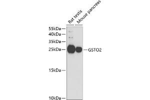 Western blot analysis of extracts of various cell lines, using GSTO2 antibody (ABIN6131725, ABIN6141477, ABIN6141479 and ABIN6221455) at 1:1000 dilution.