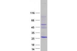 Western Blotting (WB) image for NFKB Inhibitor Interacting Ras-Like 2 (NKIRAS2) (Transcript Variant 3) protein (Myc-DYKDDDDK Tag) (ABIN2727349)