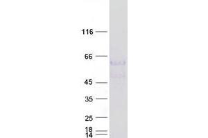 Western Blotting (WB) image for Lipase, Endothelial (LIPG) protein (Myc-DYKDDDDK Tag) (ABIN2724798)