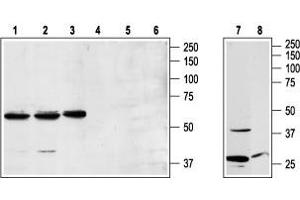 Western blot analysis of Jurkat (lanes 1 and 4), K562 (lanes 2 and 5), and RBL (lanes 3 and 6) cell lysates and rat brain lysates (lanes 7 and 8): - 1,2,3,7. (NPY1R 抗体  (3rd Intracellular Loop))