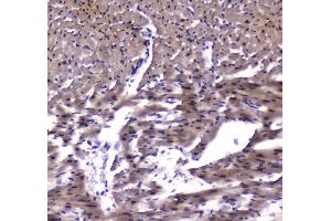 IHC analysis of ESRRG using anti-ESRRG antibody . (ESRRG 抗体  (AA 302-458))