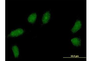 Immunofluorescence of purified MaxPab antibody to C1orf83 on HeLa cell. (TCEANC2 抗体  (AA 1-208))