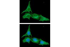 ICC/IF analysis of ATG3 in HeLa cells. (ATG3 抗体  (AA 1-314))