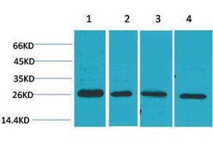Western Blotting (WB) image for anti-SLUG antibody (ABIN3181521) (SLUG 抗体)