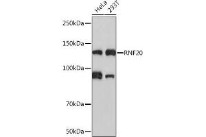 Western blot analysis of extracts of various cell lines, using RNF20 Rabbit mAb (ABIN7270071) at 1:1000 dilution. (RNF20 抗体)