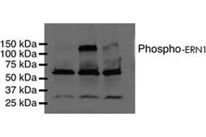 Western blot analysis of phosphorylated ERN1 using ERN1 (phospho S724) polyclonal antibody . (ERN1 抗体  (pSer724))