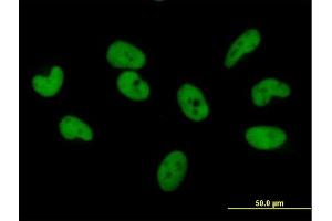 Immunofluorescence of purified MaxPab antibody to ZNF680 on HeLa cell. (ZNF680 抗体  (AA 1-530))
