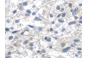Immunohistochemistry (IHC) image for anti-Fumarate Hydratase (FH) (AA 45-188) antibody (ABIN7444424)