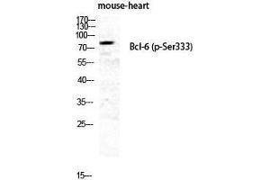 Western Blotting (WB) image for anti-B-Cell CLL/lymphoma 6 (BCL6) (pSer333) antibody (ABIN3173113) (BCL6 抗体  (pSer333))