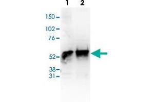 Western Blot (Cell lysate) analysis of (1) 25 ug whole cell extracts of Hela cells, (2) 25 ug nuclear extracts of Hela cells. (HDAC1 抗体  (C-Term))