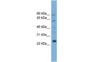 WB Suggested Anti-BCL7A  Antibody Titration: 0. (BCL7A 抗体  (Middle Region))