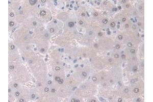 Detection of GDA in Human Liver Tissue using Polyclonal Antibody to Guanine Deaminase (GDA) (GDA 抗体  (AA 1-454))