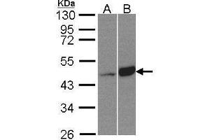 WB Image Sample(30 μg of whole cell lysate) A:HeLa S3, B:Raji, 10% SDS PAGE antibody diluted at 1:500 (BCKDK 抗体)
