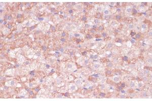 Immunohistochemistry of paraffin-embedded Rat adrenal gland using CYP11B2 Polyclonal Antibody at dilution of 1:100 (40x lens). (CYP11B2 抗体)
