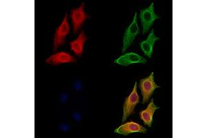 ABIN7094554 and ABIN7098603 staining HepG2 cells by IF/ICC. (DNASE2 抗体  (Internal Region))