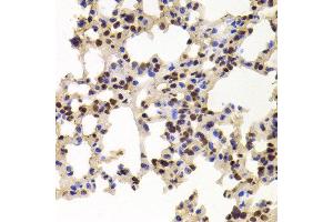 Immunohistochemistry of paraffin-embedded Mouse lung using PPAT antibody at dilution of 1:100 (x400 lens). (PPAT 抗体)
