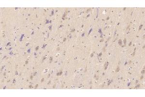 Detection of NT-ProBNP in Human Cerebrum Tissue using Monoclonal Antibody to N-Terminal Pro-Brain Natriuretic Peptide (NT-ProBNP) (NT-ProBNP 抗体)