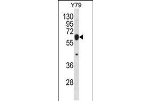 Western blot analysis in Y79 cell line lysates (35ug/lane). (RNF180 抗体  (C-Term))