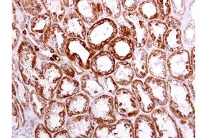 IHC-P Image ACAT1 antibody [N1N3] detects ACAT1 protein at cytoplasm on human normal kidney by immunohistochemical analysis.