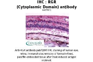 Image no. 1 for anti-Retinal G Protein Coupled Receptor (RGR) (3rd Cytoplasmic Domain) antibody (ABIN1738848) (RGR 抗体  (3rd Cytoplasmic Domain))