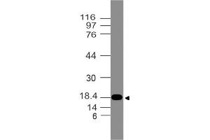 Image no. 1 for anti-Filaggrin Family Member 1 (FLG1) (AA 1-300) antibody (ABIN5027200) (Filaggrin-1 抗体  (AA 1-300))