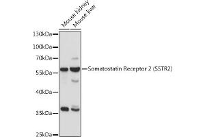 Western blot analysis of extracts of various cell lines, using Somatostatin Receptor 2 (SSTR2) antibody (ABIN7270493) at 1:1000 dilution. (SSTR2 抗体  (C-Term))