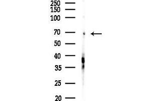 Western blot analysis of lysates from Hela cells(LPS, 4h treatment), using SLC6 Antibody at 1/1000 dilution.